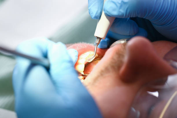 Best Broken or Cracked Tooth Emergency Dentist in Fort Leonard Wood, MO